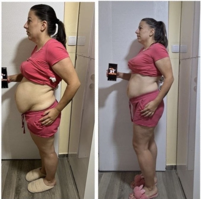 Mia transformation